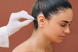 Auriculoterapia na All Care Fisioterapia em Santo André